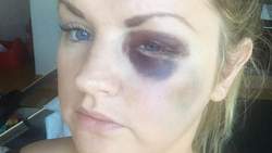 Il frappe au visage deux demoiselles d’honneur durant son mariage