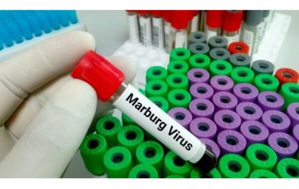 Six décès liés au virus Marburg au Rwanda, les autorités renforcent la surveillance