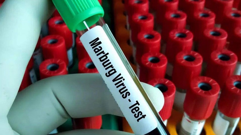 Le virus Marburg au Rwanda, une menace mortelle et une réponse urgente des autorités sanitaires