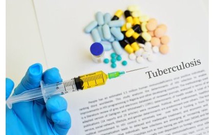 Tuberculose au Rwanda : Plus de 5 500 cas enregistrés en 2021/2022